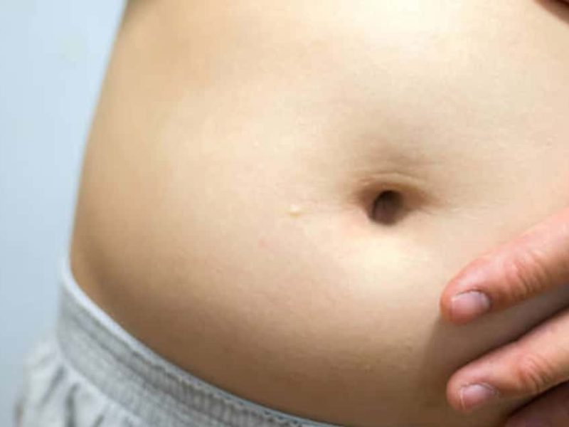 12 maneiras de diminuir a barriga inchada