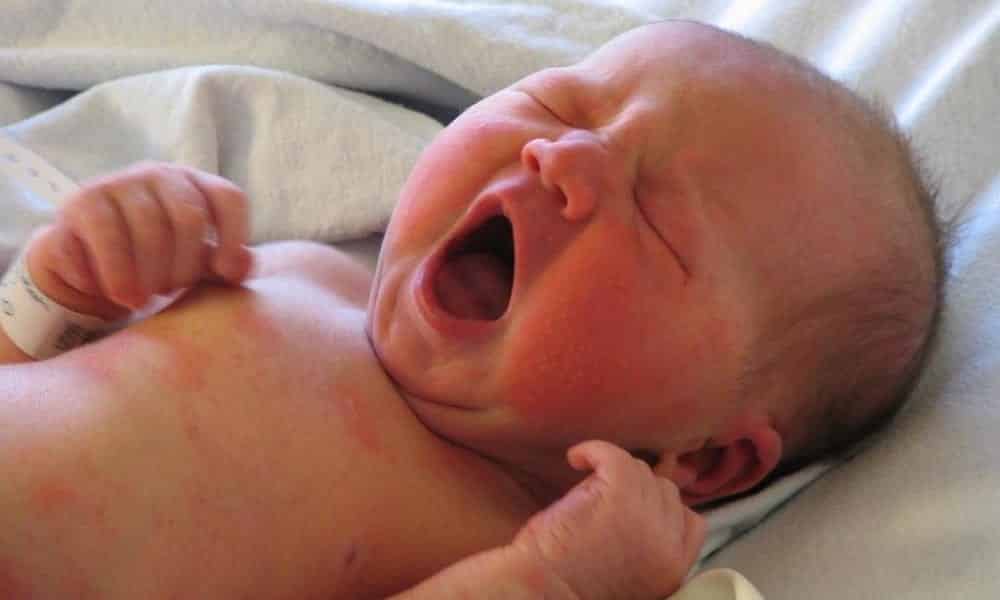 10 formas simples de aliviar cólicas de bebes