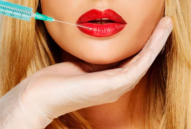 O que é o preenchimento labial, quanto custa, contraindicações