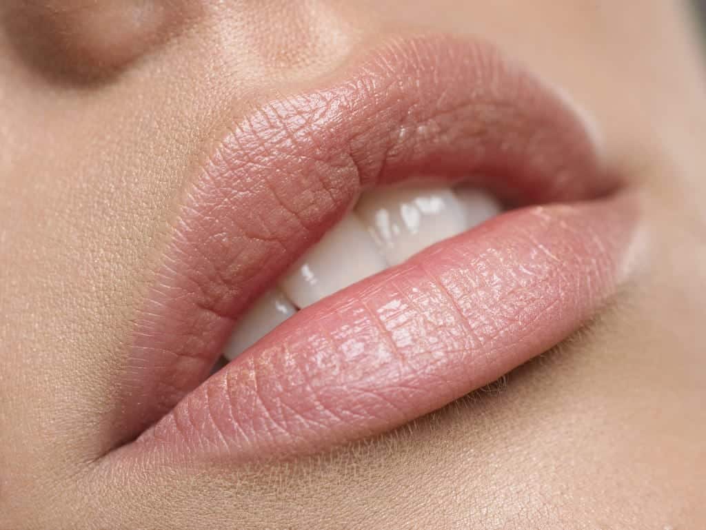 O que é o preenchimento labial, quanto custa, contraindicações