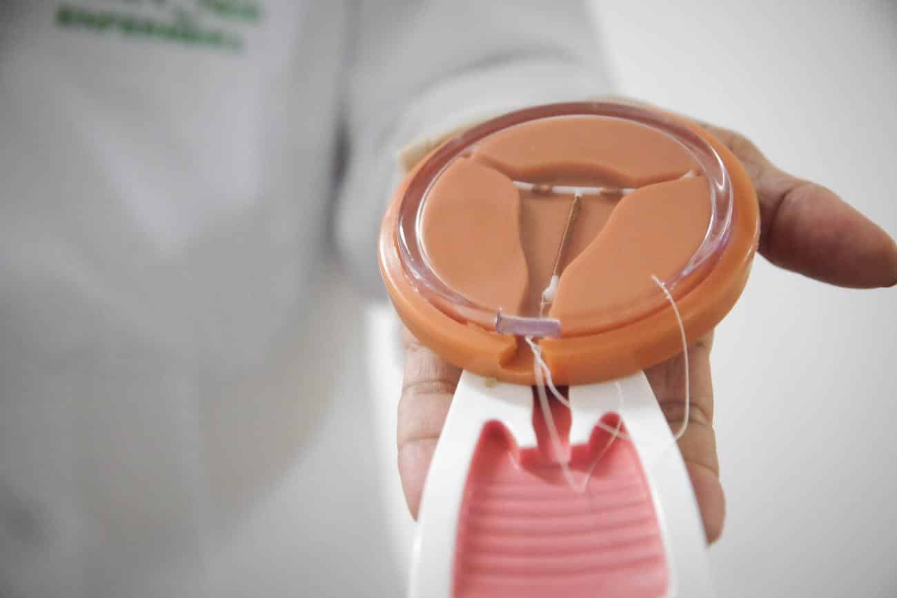 Tipos de DIU: como funcionam e quais as vantagens de cada um